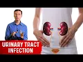 Download Lagu Top Remedies for a UTI (Urinary Tract Infection: Updated)