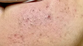 Satisfying video with Chung Vo Spa | 401