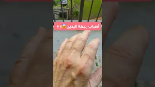 إليكم أسباب رعشة رجفة اليدين  إليكم أسباب رعشة رجفة اليدين