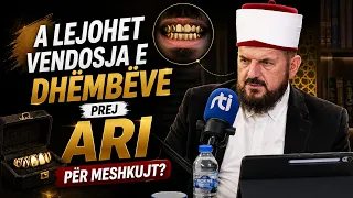A lejohet vendosja e dhëmbëve prej ari për meshkujt? - Dr. Shefqet Krasniqi