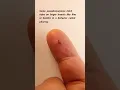 Download Lagu Pseudoscorpions Take the Bug Taxi!