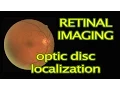 Retinal Image Processing in MATLAB Optic Disc Localization