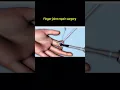 Respect the Surgical Tech