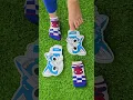 Download Lagu Which socks and sandals suit her ? 🧦😲🦶 #love #slippers #viralvideoshort
