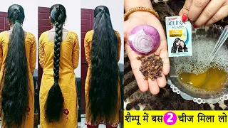 शैम्पू में सिर्फ 2 चीज़ मिलाकर लगालो बाल 200 गुना तेजी से बढ़ेंगे Shampoo mein ye milakar lagaen