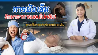  การรักษาอาการนอนไม่หลับด้วยการฝังเข็มทำอย่างไร 