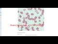 Leukemia Blood Cancer Detection Using Python Code Leukemia Blood Cancer Identification