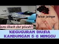 Download Lagu Keguguran diusia kehamilan 5-6 minggu