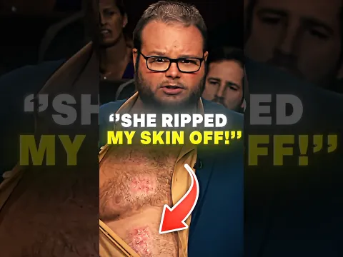 Man Sues Salon For RIPPING His Skin Off 🤯