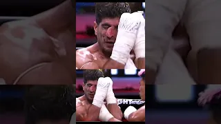 Broke My Nose Boxing Boxer Fighter Martialarts Mma 