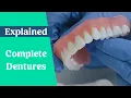 Complete dentures false teeth explained