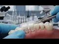 South Korean Scientists Create Tooth regrowth Patch that could Eliminate Dentures and Implants perma