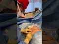 Patient Journey Small Chest Thin Patient - Breast Augmentation