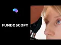 Fundoscopy Ophthalmoscopy - OSCE Guide UKMLA CPSA PLAB 2