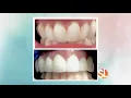 AZ Dental Wellness offering affordable dental care throughout the Valley