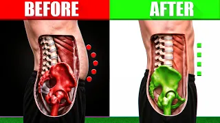 Anterior Pelvic Tilt = Pooch Belly. Here's The Fix