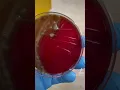 Streptococcus pneumoniae