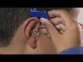 How to place Oticon Sensei BTE hearing aid with mould