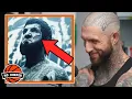 Download Lagu Alex Terrible Explains The Scar on his Face