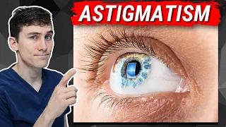 Astigmatism Explained - What You Need to Know