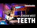 Jordan West Teeth