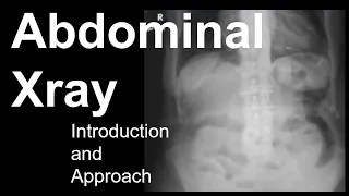 Abdominal X-Ray Introduction and Approach