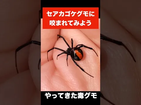 毒グモ『セアカゴケグモ』にかまれるとこうなる
