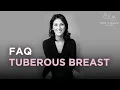 Tuberous Breast Deformity - Frequently Asked Questions