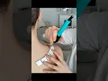 Download Lagu Shoulder skin examination