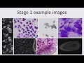 Kaggle Meetup Cell Nucleus Detection