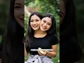 Download Lagu kisah hidup wanita cantik yang memiliki dua kepala dalam satu tubuh #viralvideo #fyp #unik