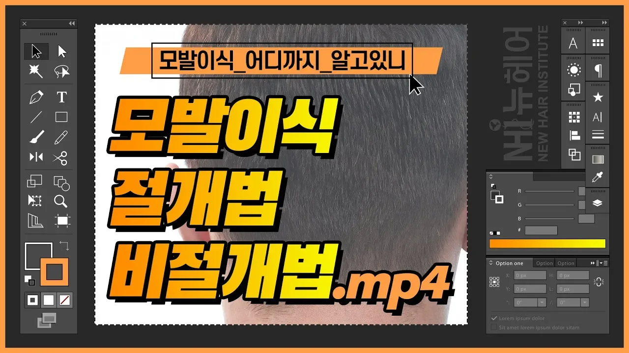 모발이식 절개법과 비절개법 차이?! - 뉴헤어 I 모발이식 I 헤어라인