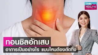  ทอนซินอักเสบเกิดจากสาเหตุอะไรบ้าง และแต่ละสาเหตุมีสัดส่วนเท่าไร 