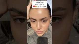 كبف تخلصت من حبوب الجبهه بكل سهوله 
