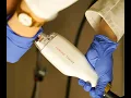 LaseMD Resurfacing Treatment