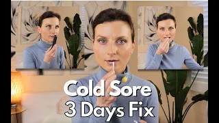 How to Treat Cold Sores Fast My 3-Day Routine for Immediate Results