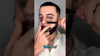 رجل يعاني من مرض نادر يجعل وجهه ينمو شعر أسود يومي ا 