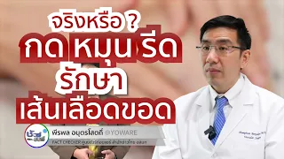 วิธีการรักษาและบรรเทาอาการของเส้นเลือดขอดที่แพทย์แนะนำมีอะไรบ้าง