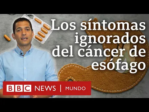 Download MP3 Cuáles son los síntomas del cáncer de esófago y por qué no debemos ignorarlos | BBC Mundo