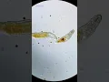 Download Lagu Worm Eats Single Celled Organism Under Microscope