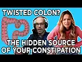 GI Doctor Unravels the Tortuous Colon Constipation s Hidden Culprit