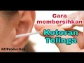 Cara Membersihkan Telinga Selama 20 Tahun Dibiarkan?