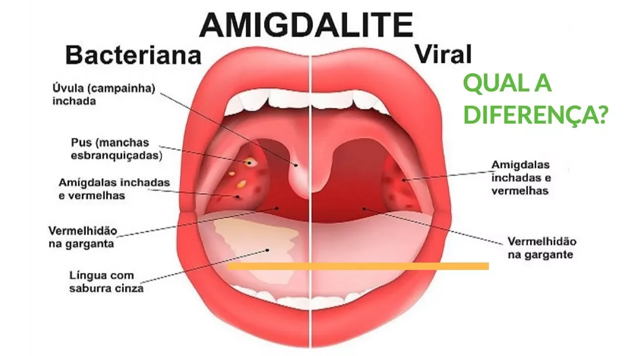 Esse chá é perfeito para curar gripe, dor de garganta e resfriado. Então se você está começando a se. 