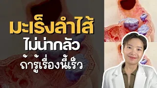 อาการใดบ้างที่อาจบ่งบอกถึงมะเร็งลำไส้ในระยะเริ่มต้น