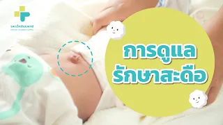  สะดือของทารกมีอาการผิดปกติอย่างไรบ้างที่ควรรีบพบแพทย์ 