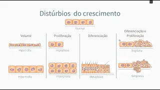 Displasia e Neoplasia - Colo uterino  - Descrição histo e citopatológicos