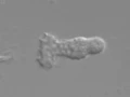16 7 Chemotaxis of Neutrophils