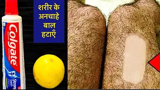 यह चीज़ लगाएं सिर्फ़ 3 मिनट में अनचाहे बाल जड़ से ख़त्म हो गए Hair Removal home remedy