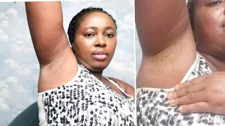 lighten up your armpits in less than 3 days diy lighten dark underarms diy armpits odour