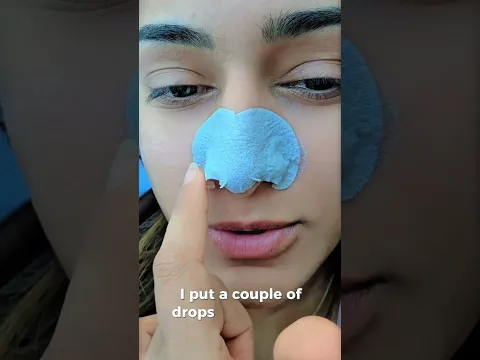 BLACKHEAD REMOVAL THAT ACTUALLY WORKS!